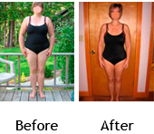 Karen before and after