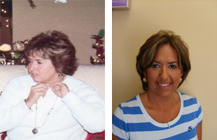 Janet Before and After
